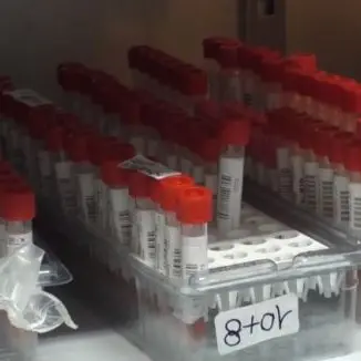 Serie A, nel Crotone un altro calciatore positivo al coronavirus