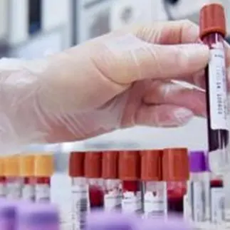 «Questa estate 500 unità di sangue in più, grazie ai donatori»