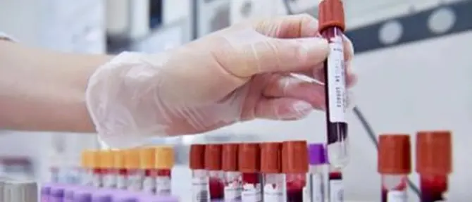 «Questa estate 500 unità di sangue in più, grazie ai donatori»