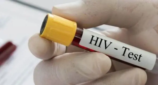 Arrestato malato di Aids che contagiava le sue donne: morta un'ex