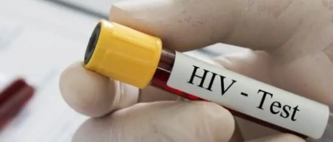 Arrestato malato di Aids che contagiava le sue donne: morta un'ex