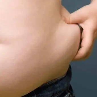 Obesità infantile, bambini calabresi tra i più in sovrappeso d’Europa