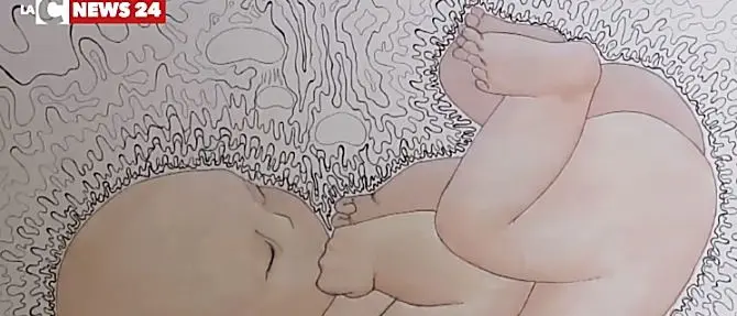 Ortopedia pediatrica, a Catanzaro la prevenzione inizia in gravidanza