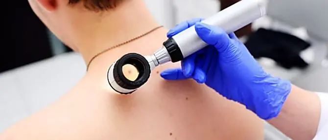 Dermatite atopica, visite gratuite a Catanzaro e Reggio Calabria