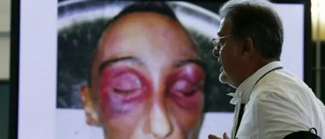 Processo Cucchi, giudice si astiene sui depistaggi: «Sono ex carabiniere»