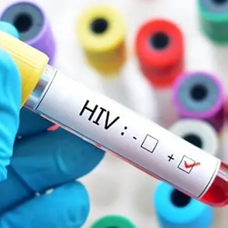 Rimini, nasconde l'Hiv e contagia l'amante: arrestato