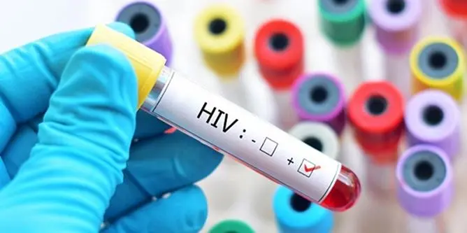 Rimini, nasconde l'Hiv e contagia l'amante: arrestato