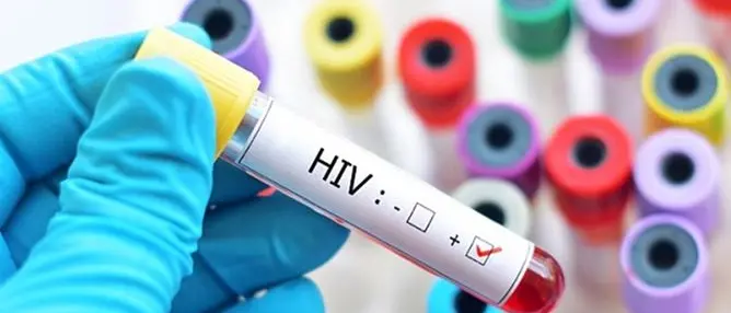Rimini, nasconde l'Hiv e contagia l'amante: arrestato