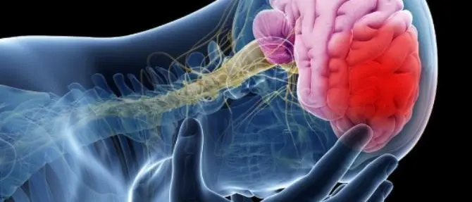 Ricerca, a Vibo Valentia focus sull’ictus cerebrale