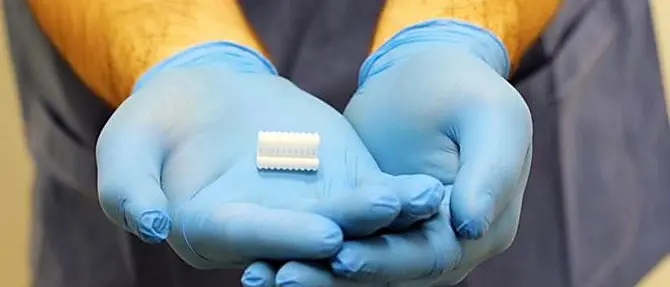 Bimbo torna a respirare con un bronco in 3D. A Roma il primo trapianto in Europa