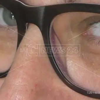 L'inferno di Anna: curata per depressione, ma è affetta da una malattia rara