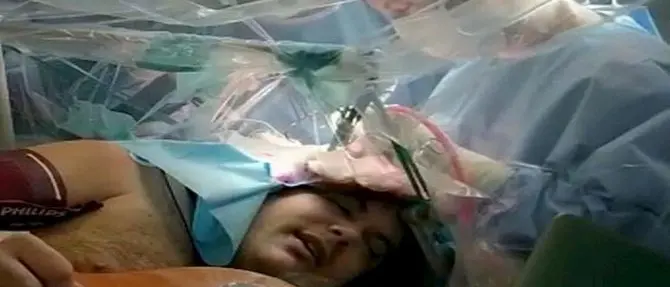 Suona la chitarra mentre lo operano al cervello, l'intervento a Torino