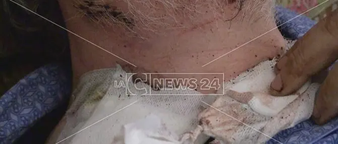 Parla il tassista accoltellato a Cosenza: «Ho avuto paura di morire»