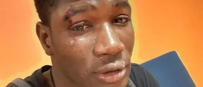 «Negro di m... vai via da qui»: insulti razzisti e botte a un senegalese