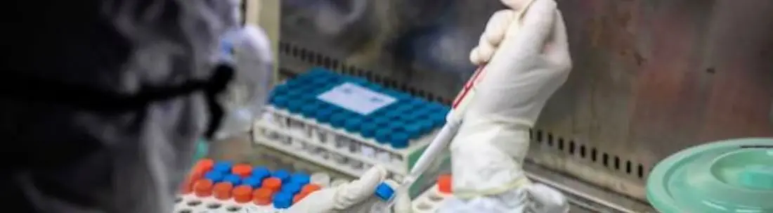 Coronavirus in Calabria, a Cetraro paziente positivo: non esiste un secondo tampone