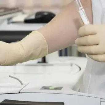 Coronavirus, lo studio: «Un esame del sangue potrà individuare i casi a rischio»