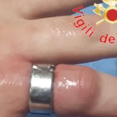 Anello troppo stretto al dito, a Catanzaro intervengono i vigili del fuoco