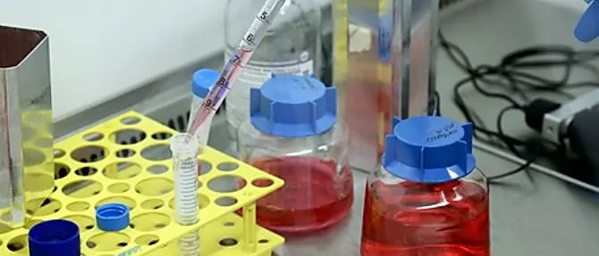 Coronavirus, un caso a Pianopoli. L’uomo è in quarantena nella sua abitazione