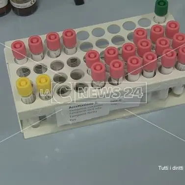 Coronavirus, a Reggio Calabria nessun nuovo caso: il bollettino del Gom