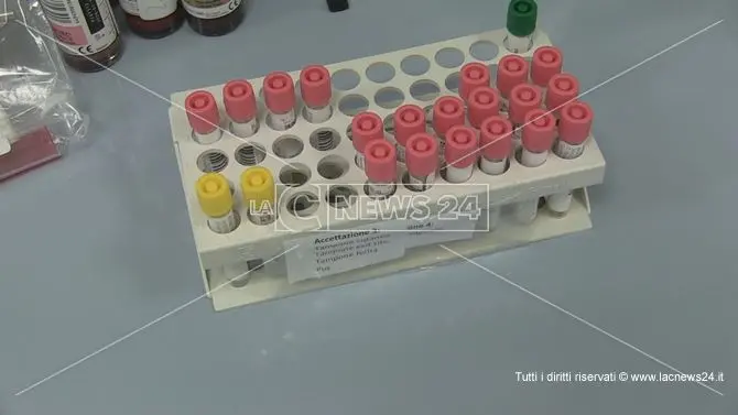 Coronavirus, a Reggio Calabria nessun nuovo caso: il bollettino del Gom