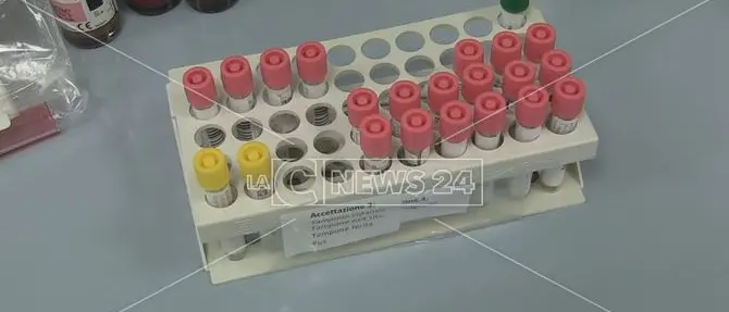 Coronavirus, a Reggio Calabria nessun nuovo caso: il bollettino del Gom