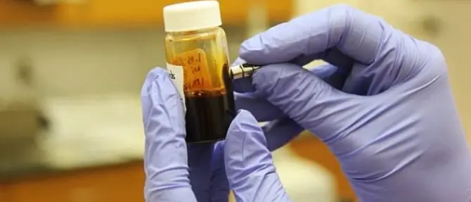 Un farmaco anti-gotta per curare il coronavirus: parte la sperimentazione