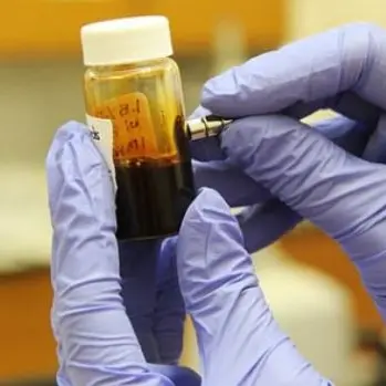 Coronavirus, a Vibo Valentia un nuovo caso: la comunicazione del sindaco