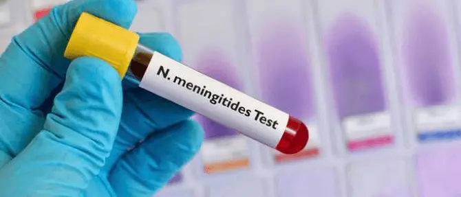 Febbre alta e segni sulle gambe, 21enne muore di meningite fulminante