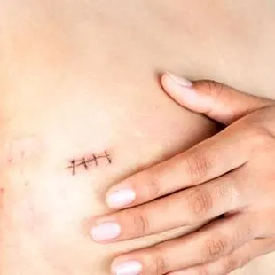 Cancro, per i pazienti oncologici a Lamezia tatuaggi paramedicali gratis