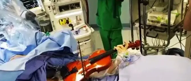 Operata di tumore al cervello mentre suona il violino: è il primo intervento al Sud
