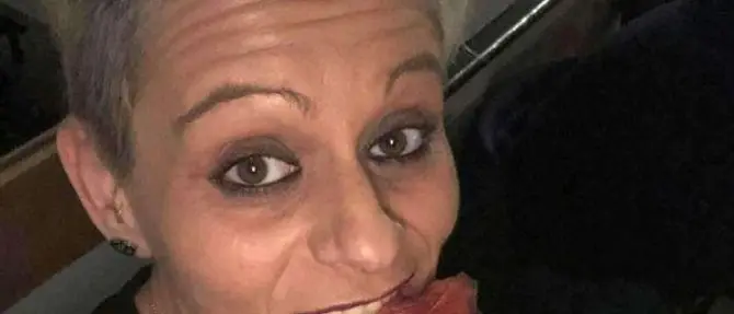 Aggredisce e sfigura l’ex fidanzato con l’acido: «Sono pentita»