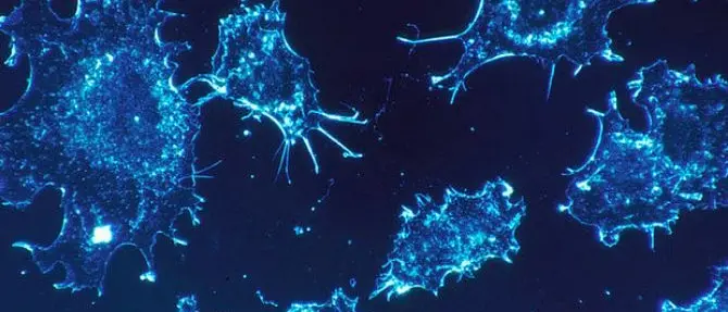 Le cellule tumorali comunicano a distanza, svolta per combattere le metastasi