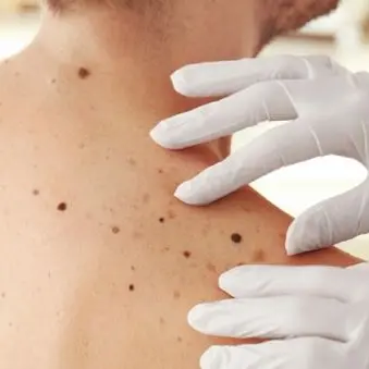 Dermatologia d’eccellenza in Calabria: «La migrazione sanitaria è finita»