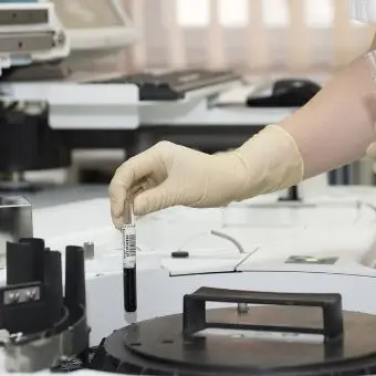 Reggio, chiude un laboratorio analisi: il sindaco scrive all’Asp