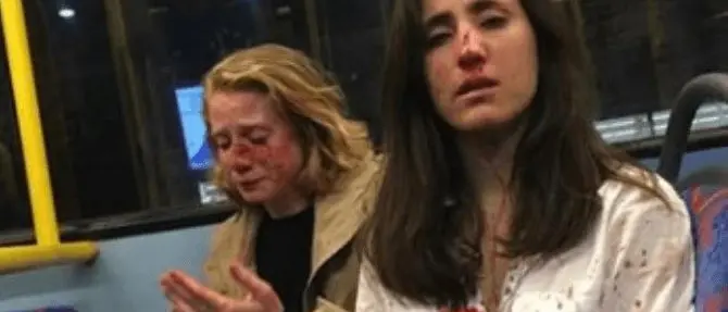 «Lesbiche baciatevi», ma la coppia si rifiuta: ragazze picchiate e derubate