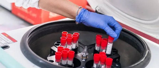 Laboratori d’analisi riducono i prelievi, a Vibo disagi per i pazienti