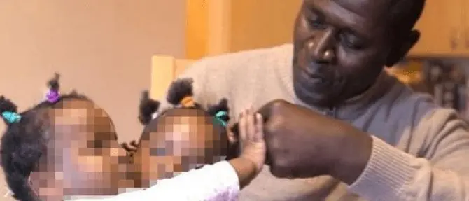 Il dramma delle gemelline siamesi senza futuro. Il padre: «Non sceglierò chi salvare»