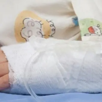 Bimba caduta dal balcone, i medici: «Condizioni gravi ma è fuori pericolo»