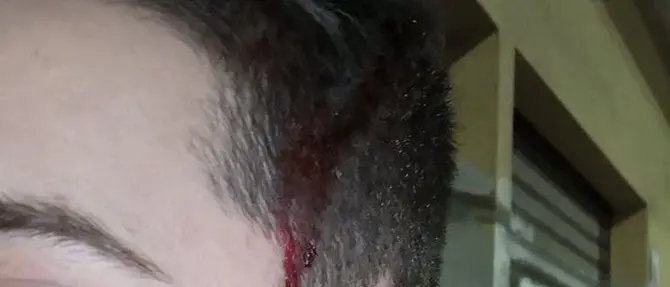 Catanzaro, aggredito a bottigliate per rubargli l'incasso del suo pub