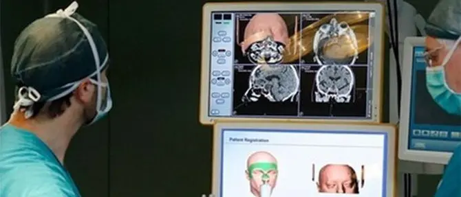 Tumori al cervello, a Cosenza il neuronavigatore per individuarli