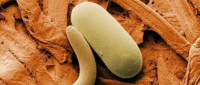 Ricadi, vermi intestinali nei bambini: scuole chiuse per disinfestazione