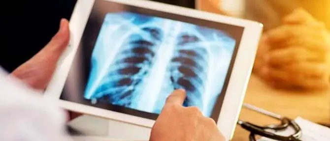 Tubercolosi, Lamezia ospita un evento scientifico in occasione del Tb day