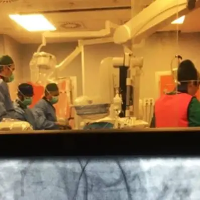 Micro-pompa per 50enne colpito da infarto, l'innovazione all’Annunziata