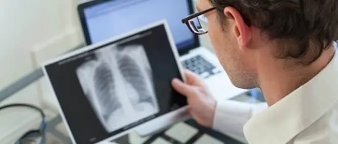 Tubercolosi, in Calabria poco meno di cento casi all'anno - VIDEO