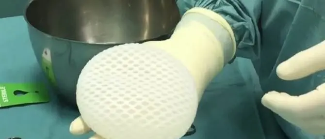 Cura del tumore al seno, è calabrese il chirurgo che utilizza una tecnica innovativa