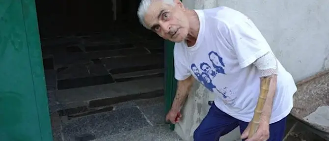 Ciccio Vinci, Le Iene e quel dente saltato nell'aggressione prima dell'autobomba