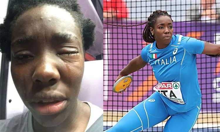 Atleta italiana di origini nigeriane aggredita: dovrà operarsi all'occhio