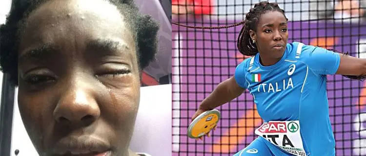 Atleta italiana di origini nigeriane aggredita: dovrà operarsi all'occhio