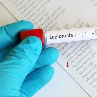 Legionella, morto il paziente ricoverato a Catanzaro