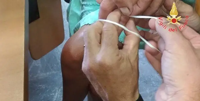 Le si gonfia il dito per via di un anello stretto, intervengono i vigili del fuoco